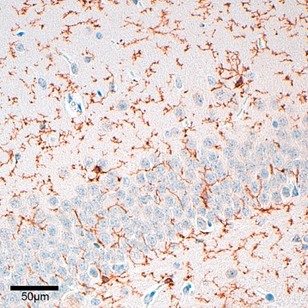 TMEM119, Polyclonal rabbit antiserum