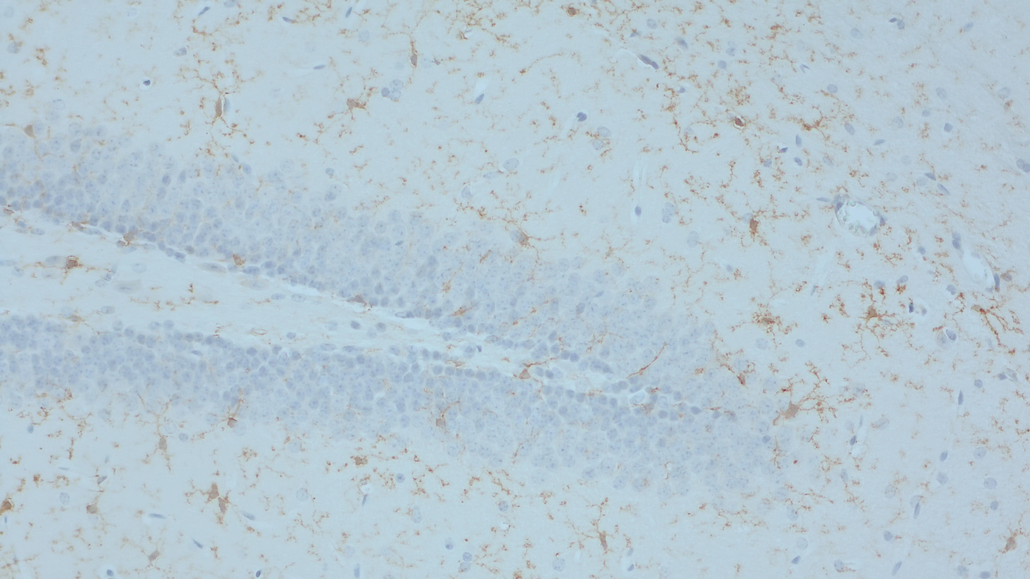 TMEM119, Recombinant chicken
