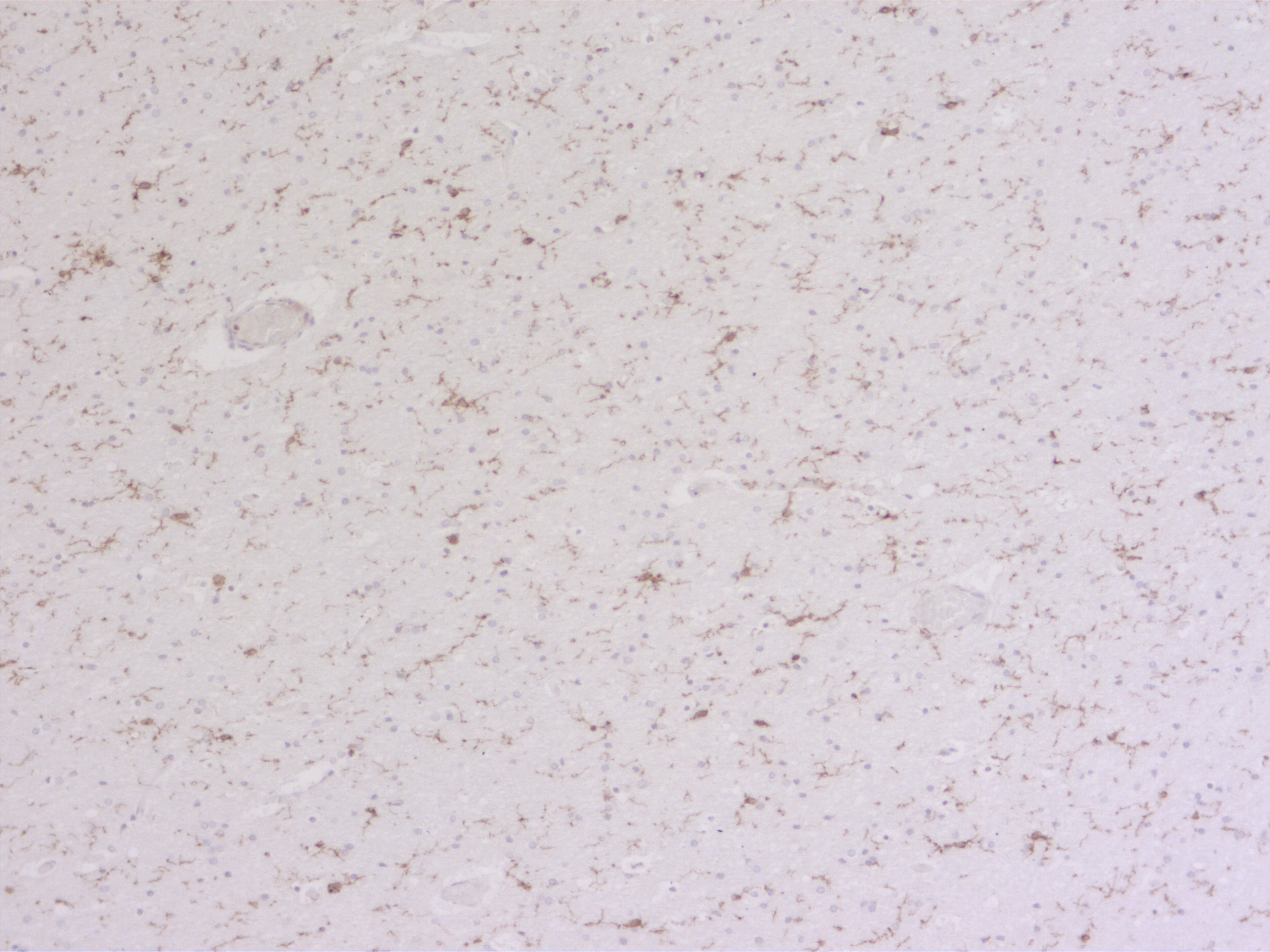 TMEM119 Polyclonal rabbit antiserum - image 1
