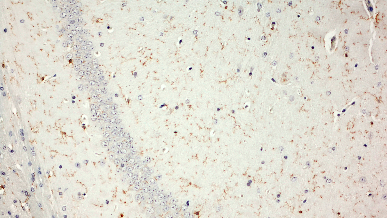 TMEM119 Recombinant Guinea pig - image 3