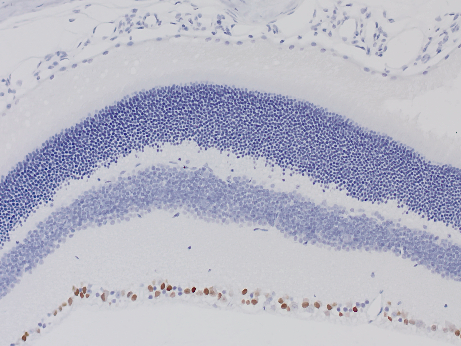 Brn3a, Recombinant rabbit