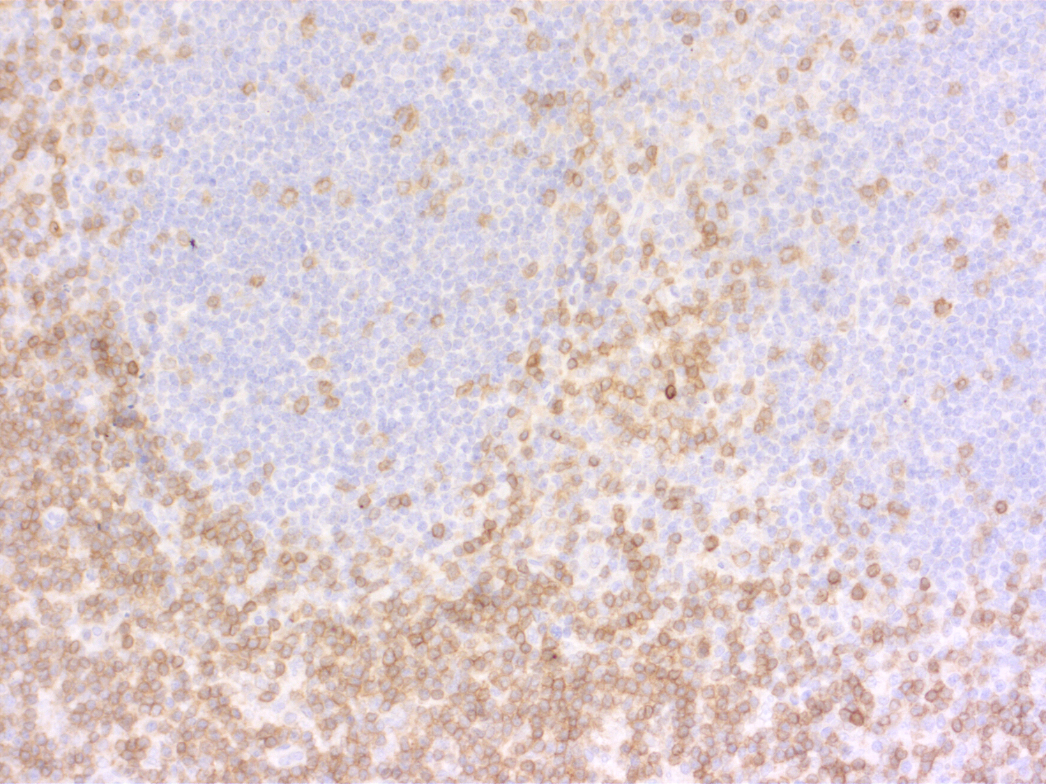 CD3e, Polyclonal rabbit purified antibody