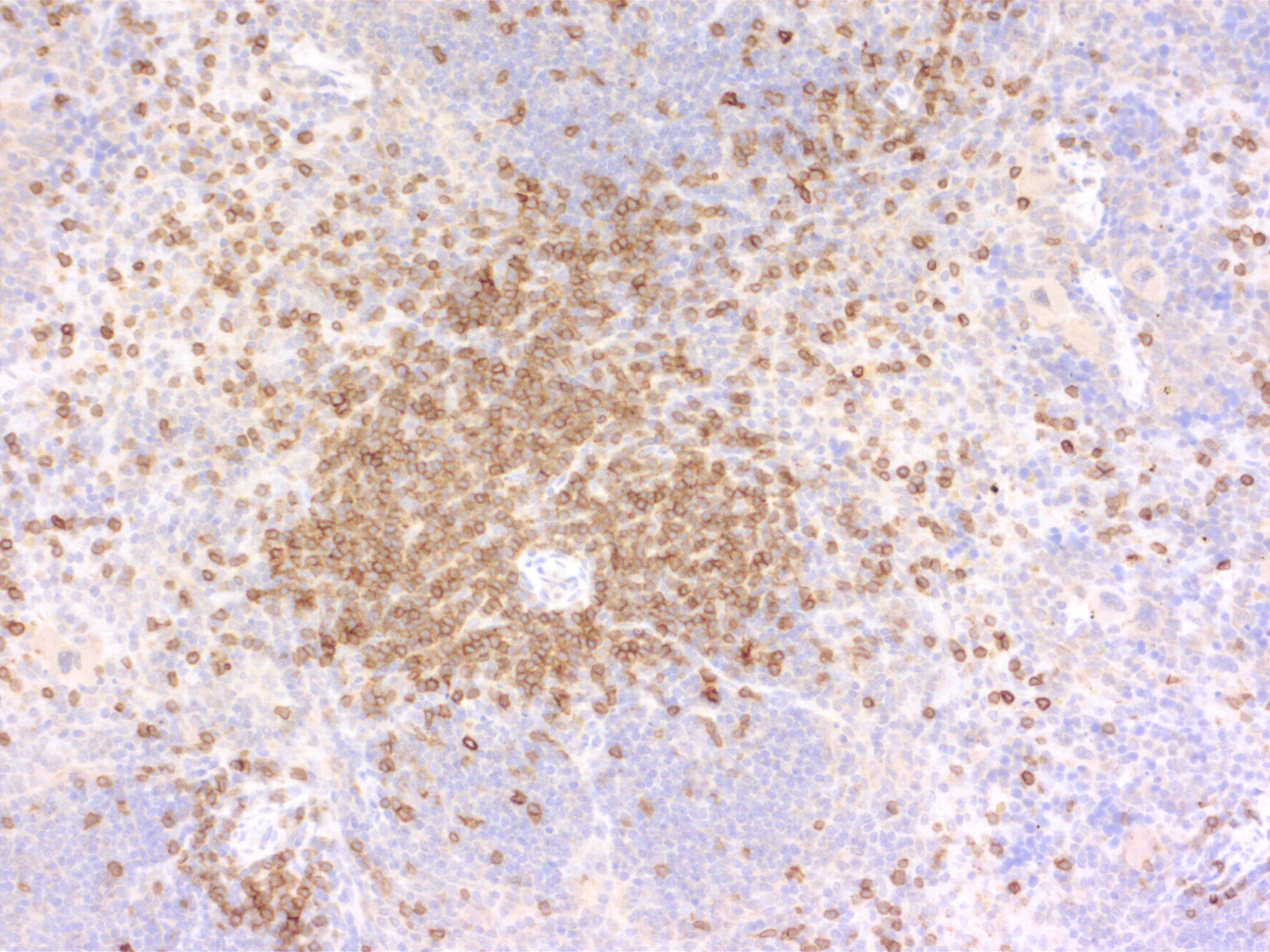 CD3e, Polyclonal rabbit purified antibody