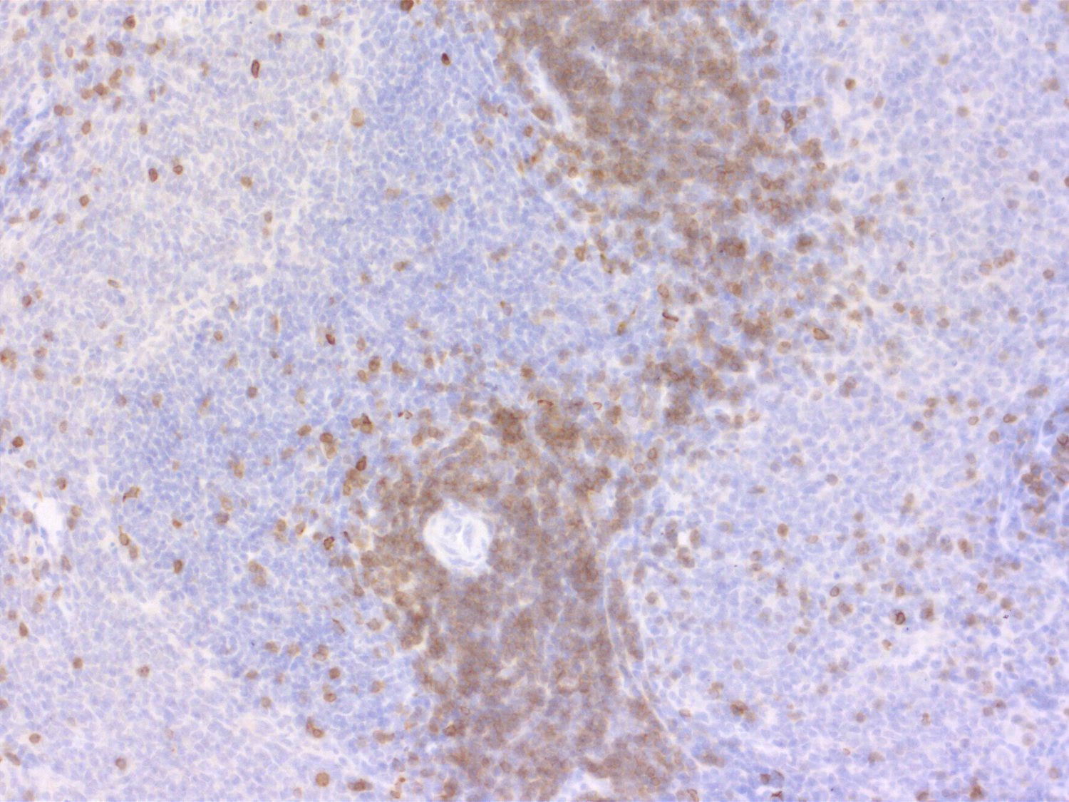 CD3e, Polyclonal rabbit purified antibody