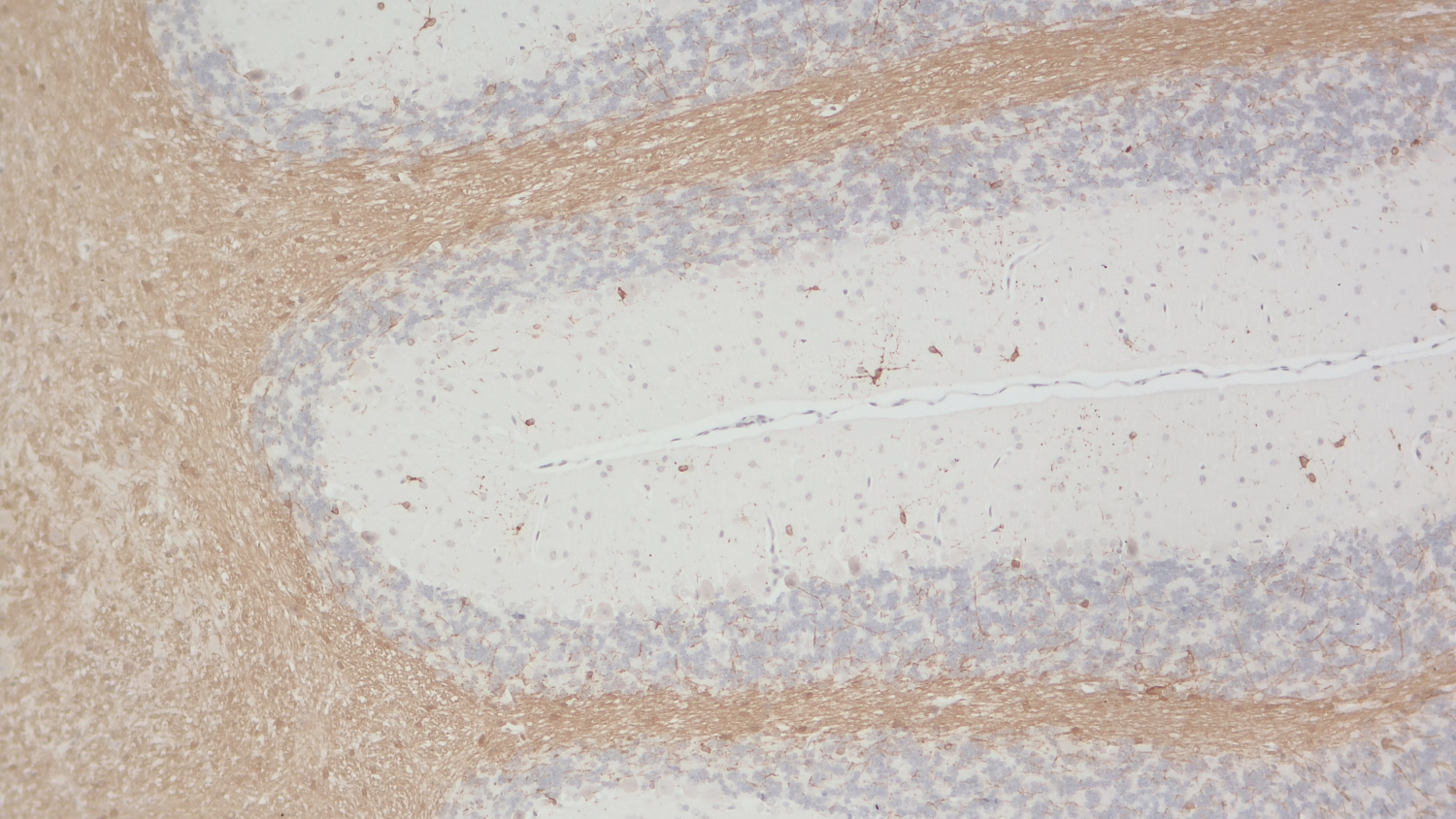 BCAS1 Polyclonal Guinea pig antiserum - image 5