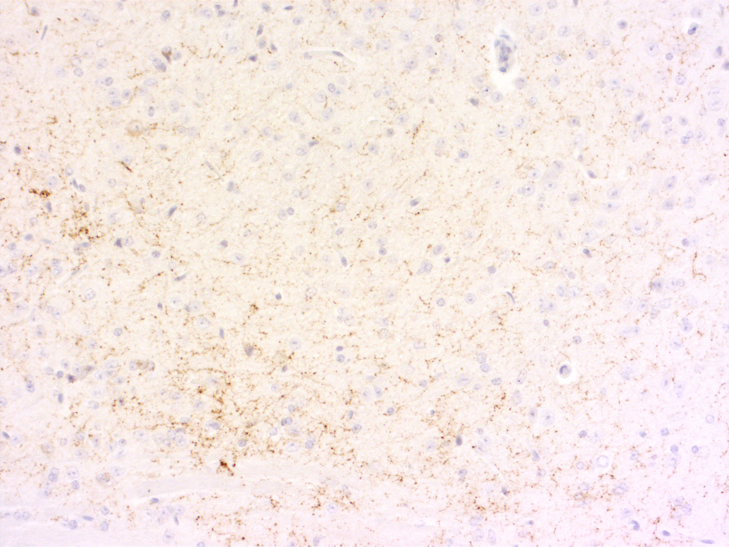Galanin, Polyclonal Guinea pig antiserum