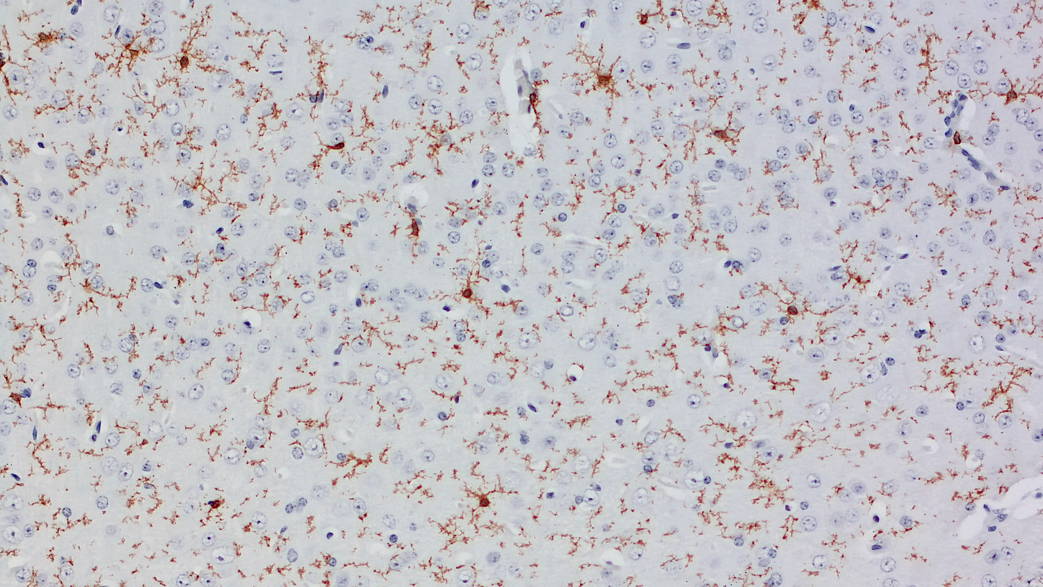 P2Y12 Recombinant rabbit - image 3