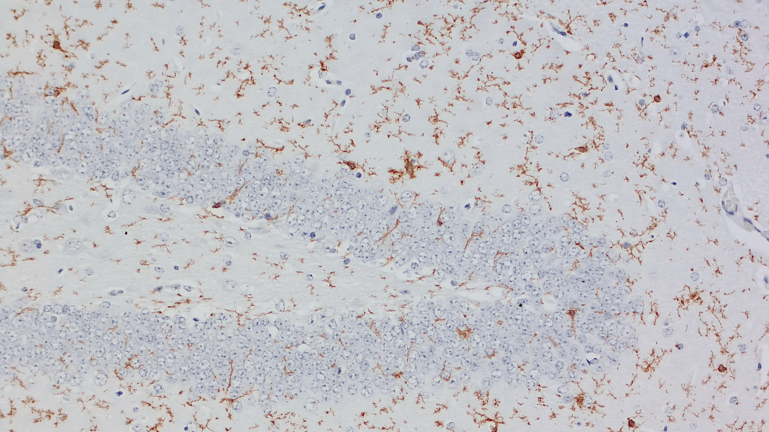 P2Y12 Recombinant rabbit - image 4