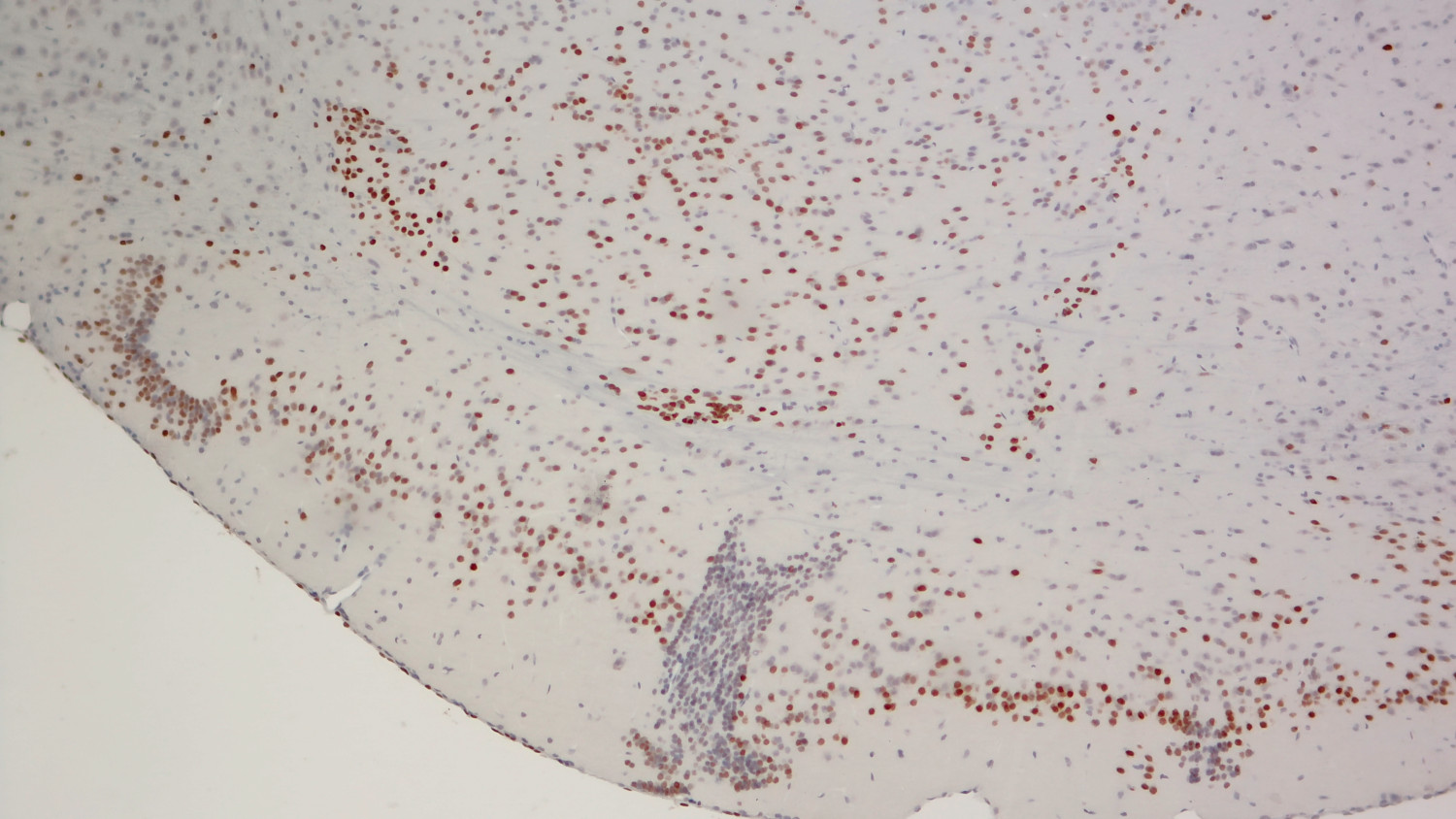 FoxP2, Polyclonal Guinea pig antiserum