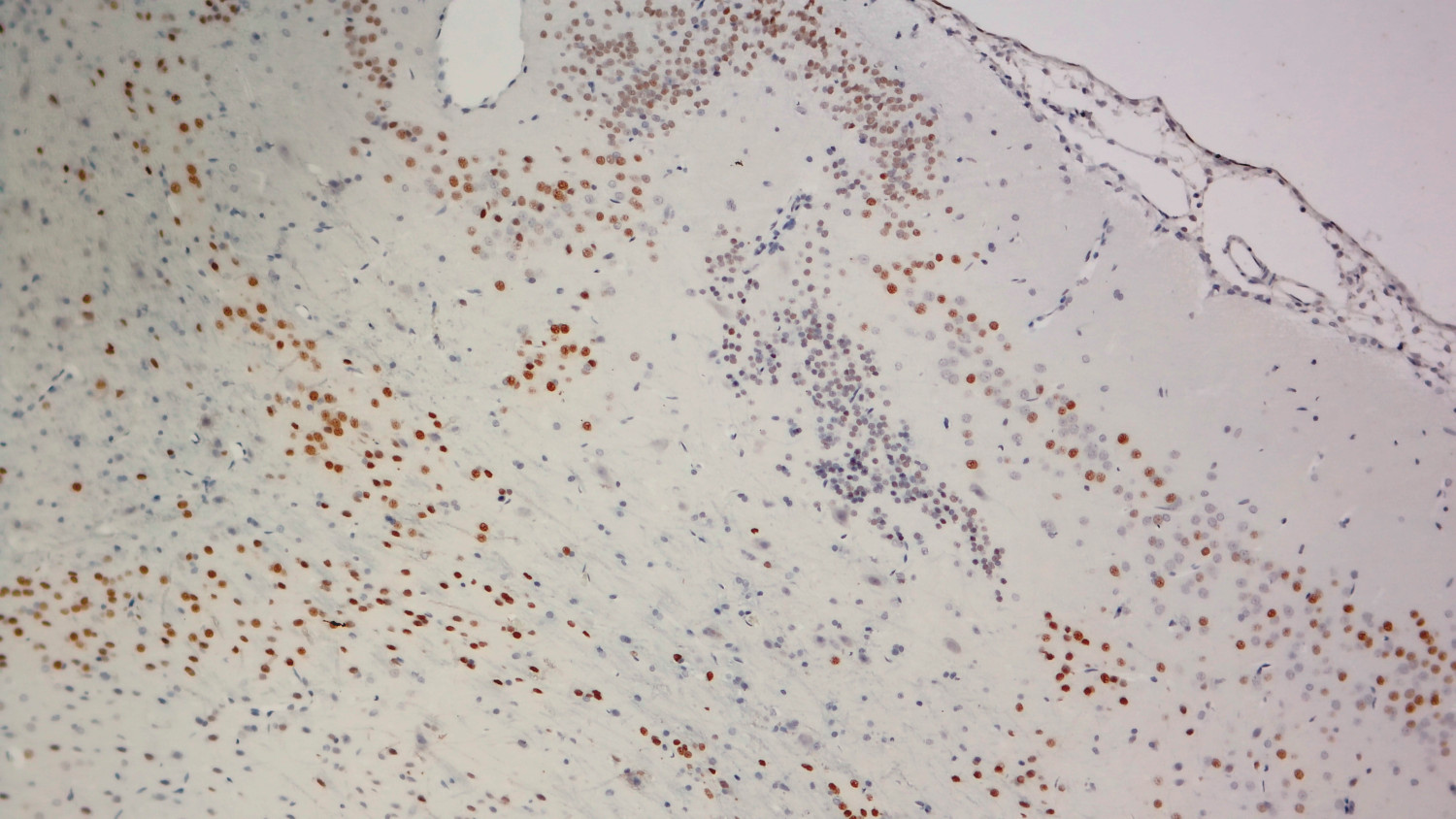 FoxP2, Polyclonal Guinea pig antiserum