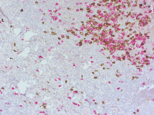 Ig lambda light chain Monoclonal rat purified IgG - image 2