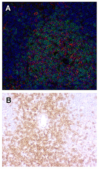 CD4, Polyclonal Guinea pig antiserum
