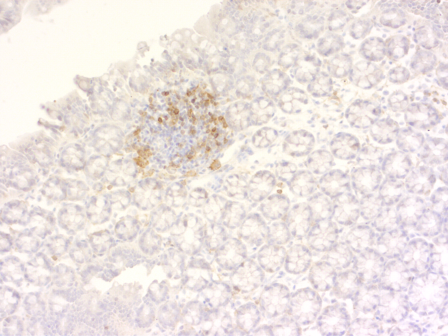CD4, Polyclonal Guinea pig antiserum