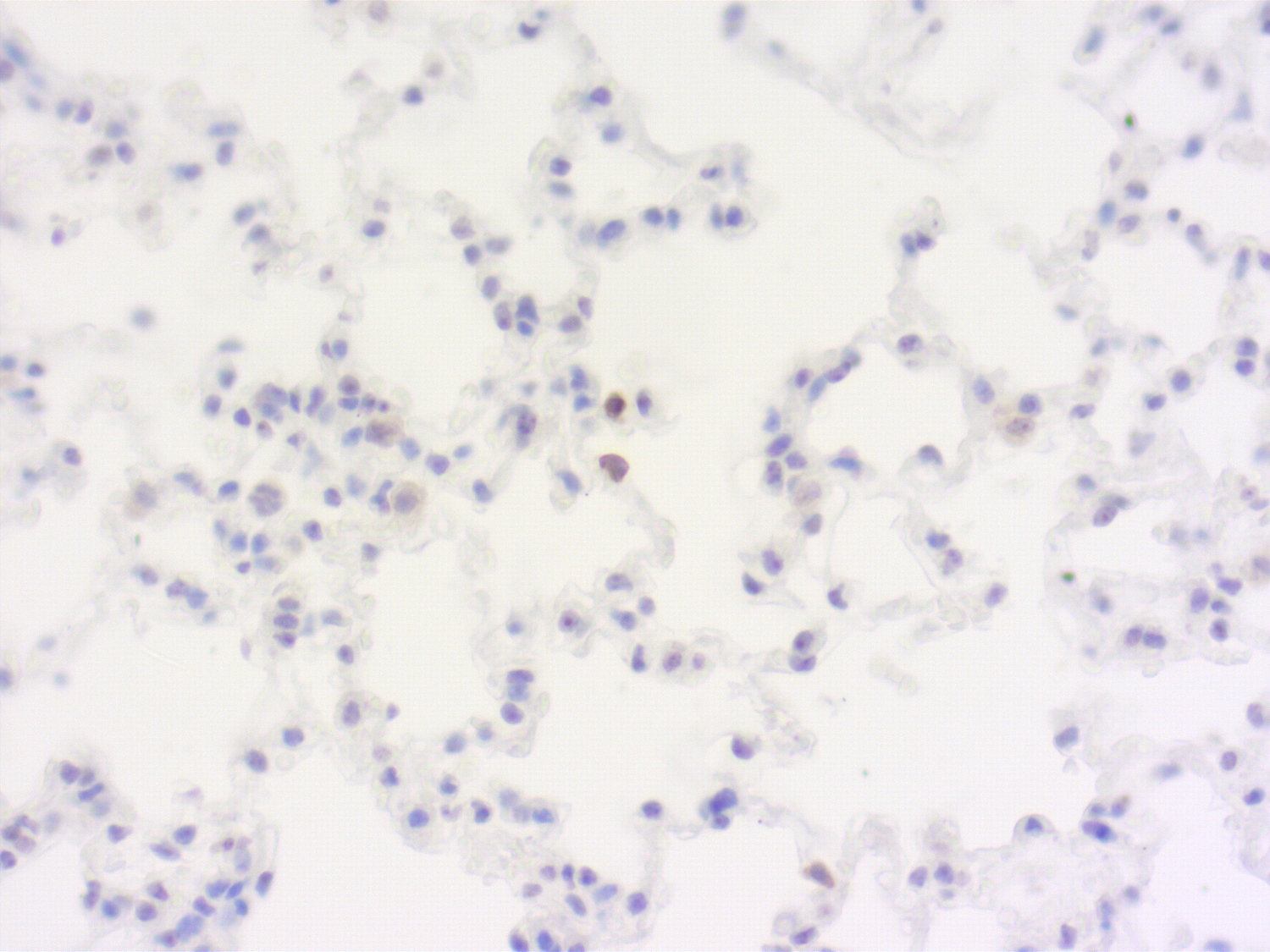 CD4, Polyclonal Guinea pig antiserum