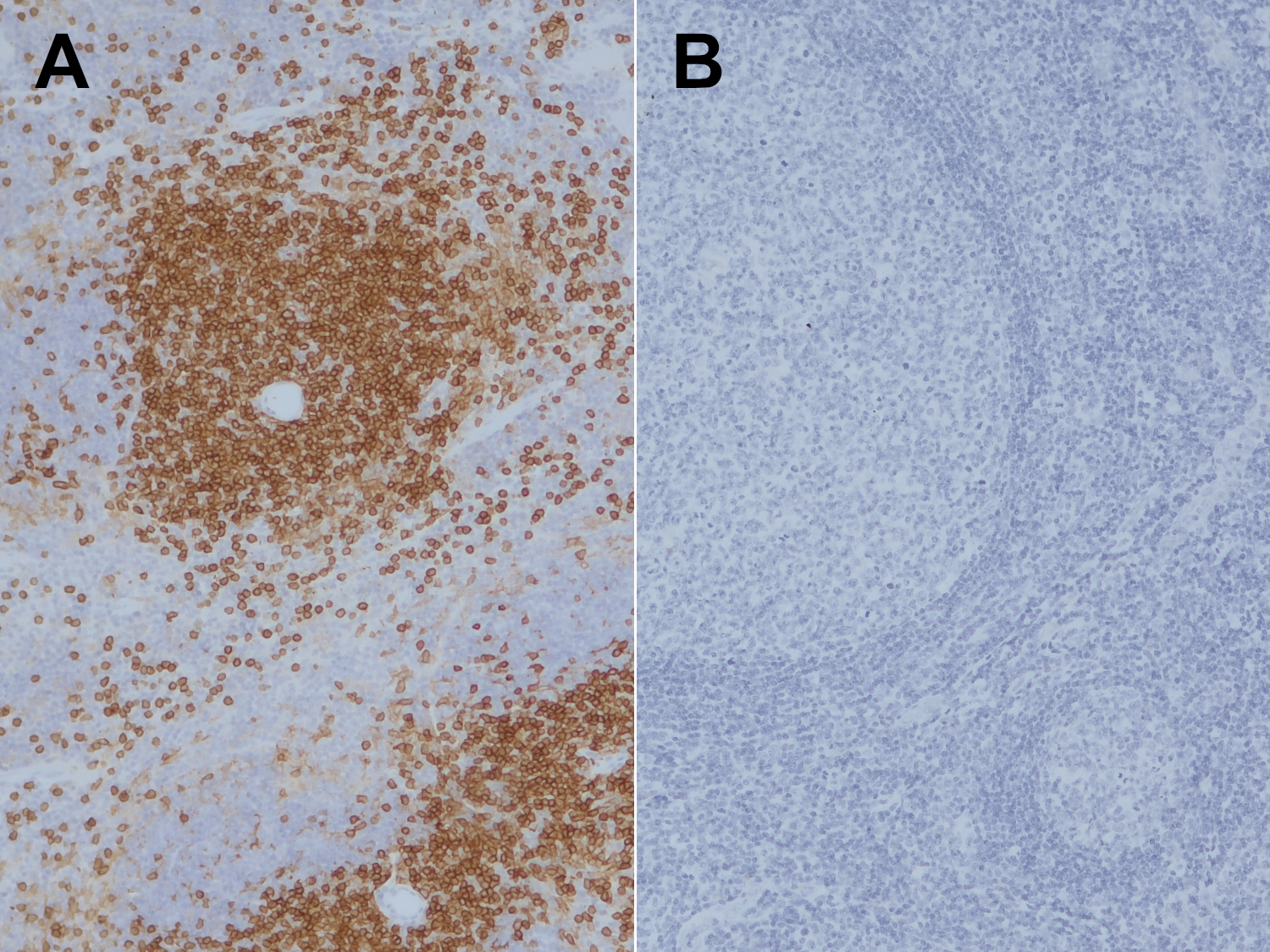 CD4, Recombinant Guinea pig
