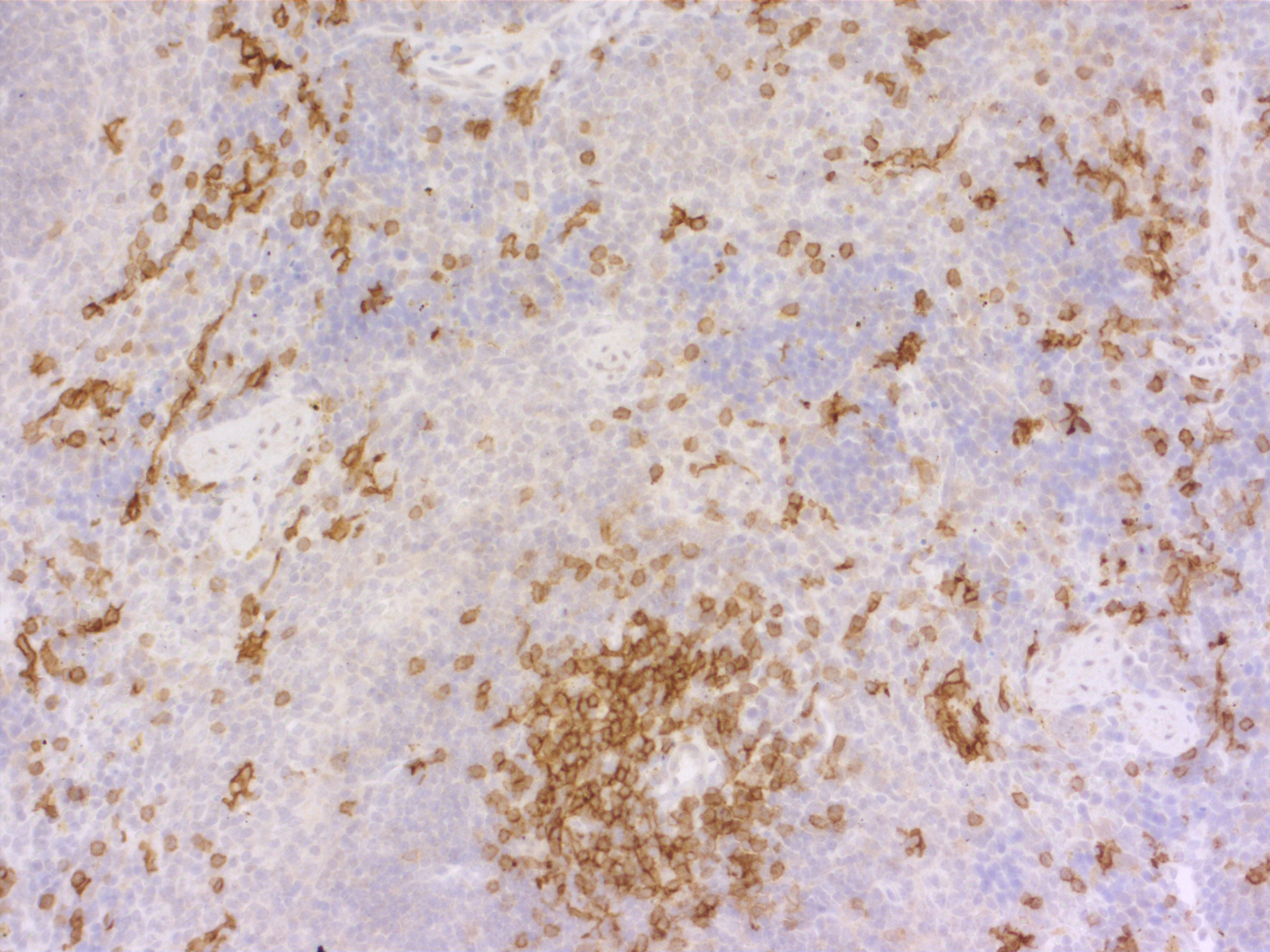 CD8a, Polyclonal rabbit purified antibody