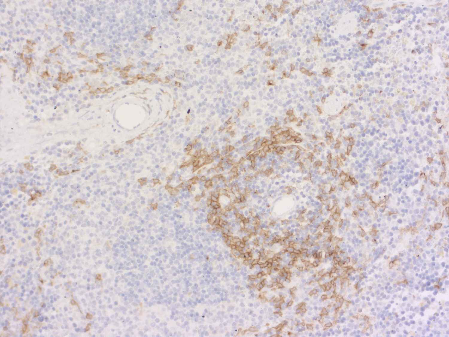 CD11c Polyclonal Guinea pig antiserum - image 3