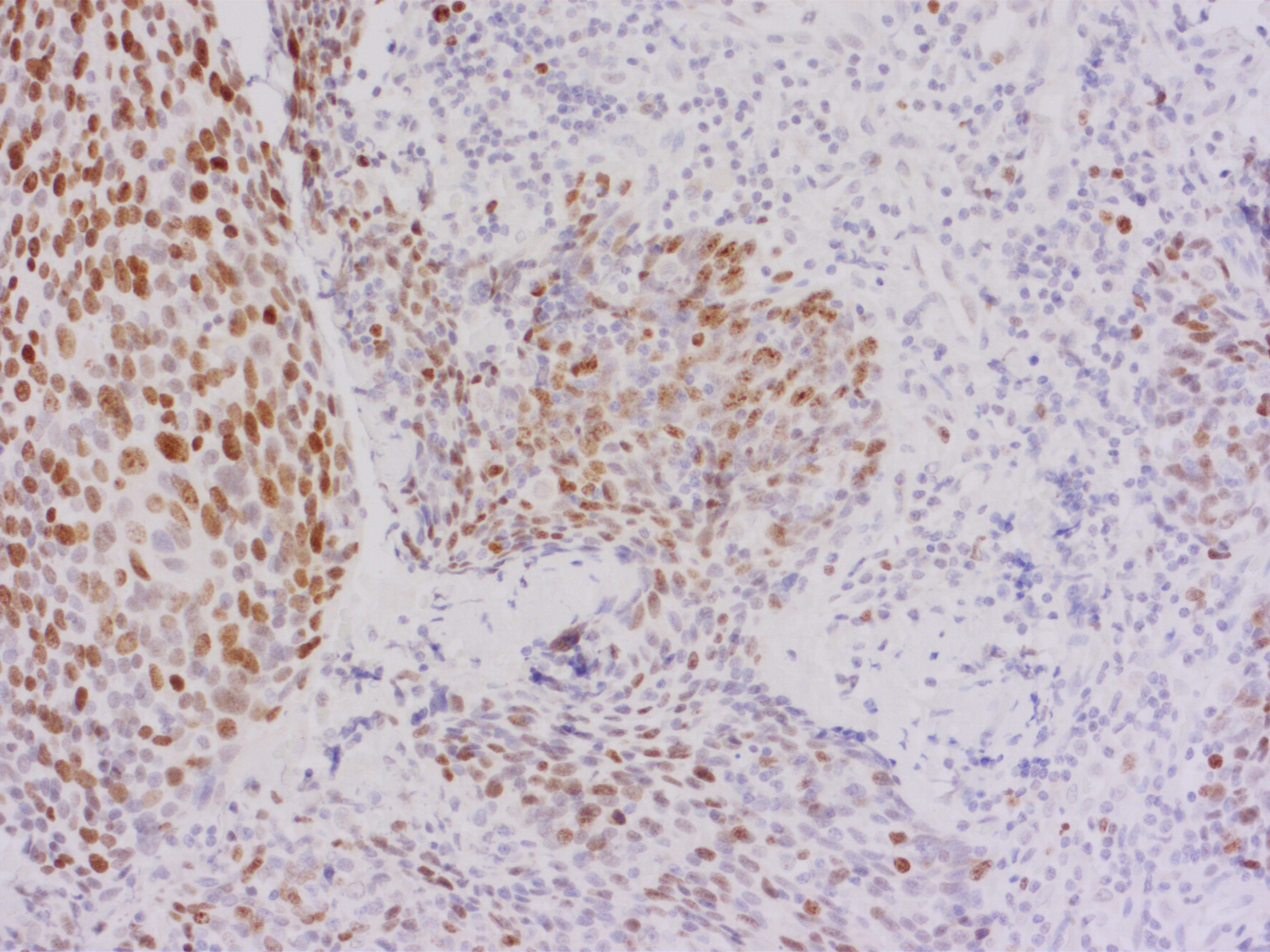 Ki67 Polyclonal rabbit antiserum - image 3