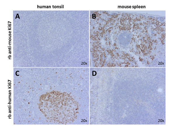 Ki67 Polyclonal rabbit antiserum - image 1