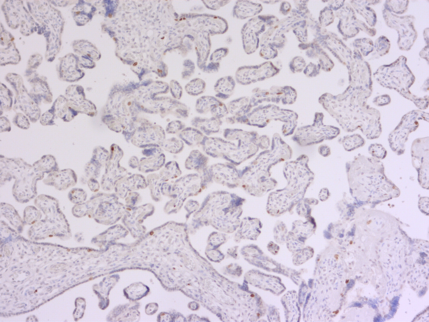 Ki67 Polyclonal rabbit antiserum - image 4