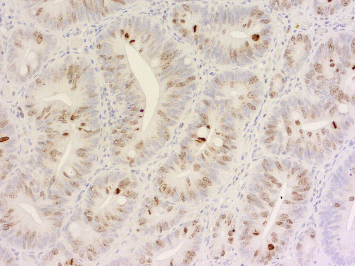 Ki67 Polyclonal rabbit antiserum - image 2