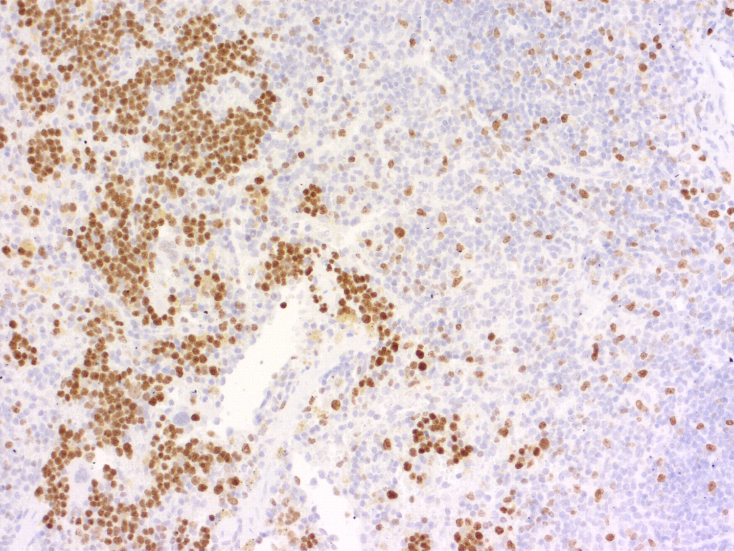 Ki67 Polyclonal rabbit antiserum - image 3