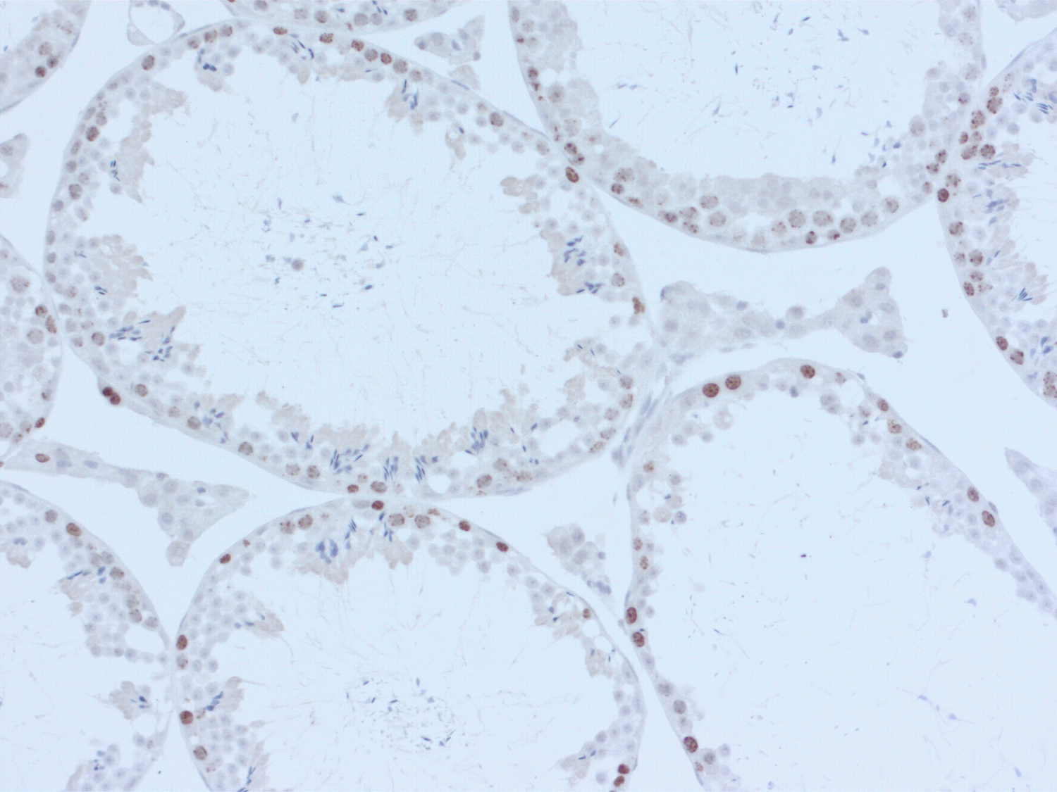 Ki67 Polyclonal rabbit antiserum - image 4