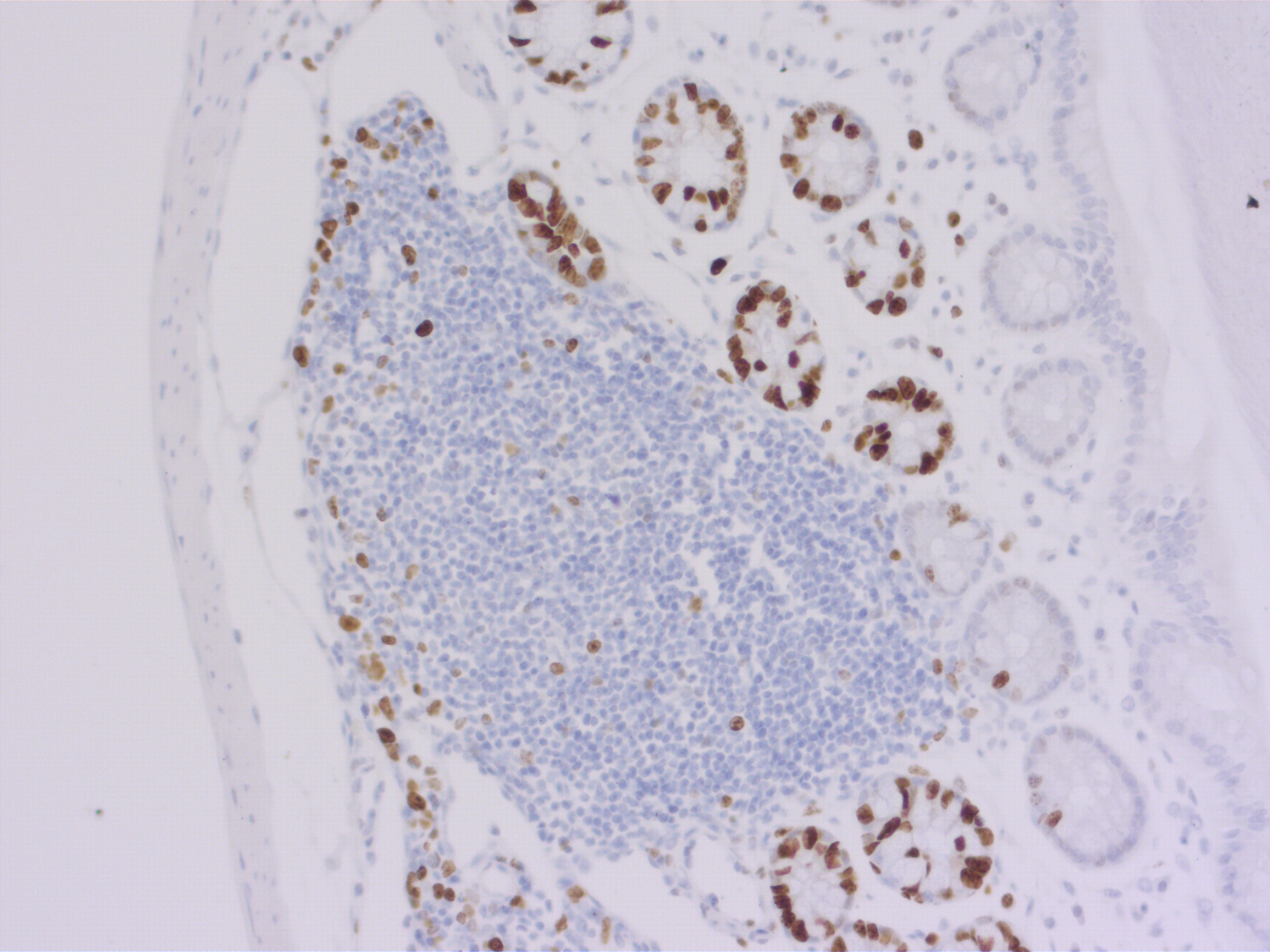 Ki67 Recombinant rabbit - image 4