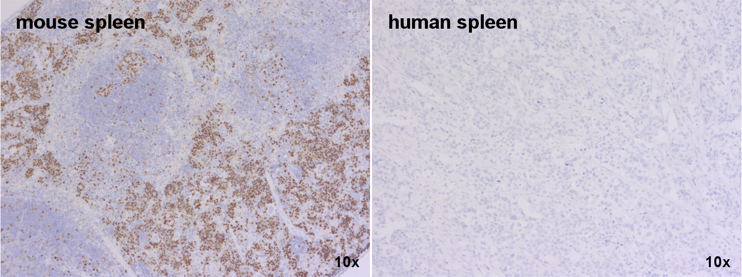 Ki67 Recombinant rabbit - image 5