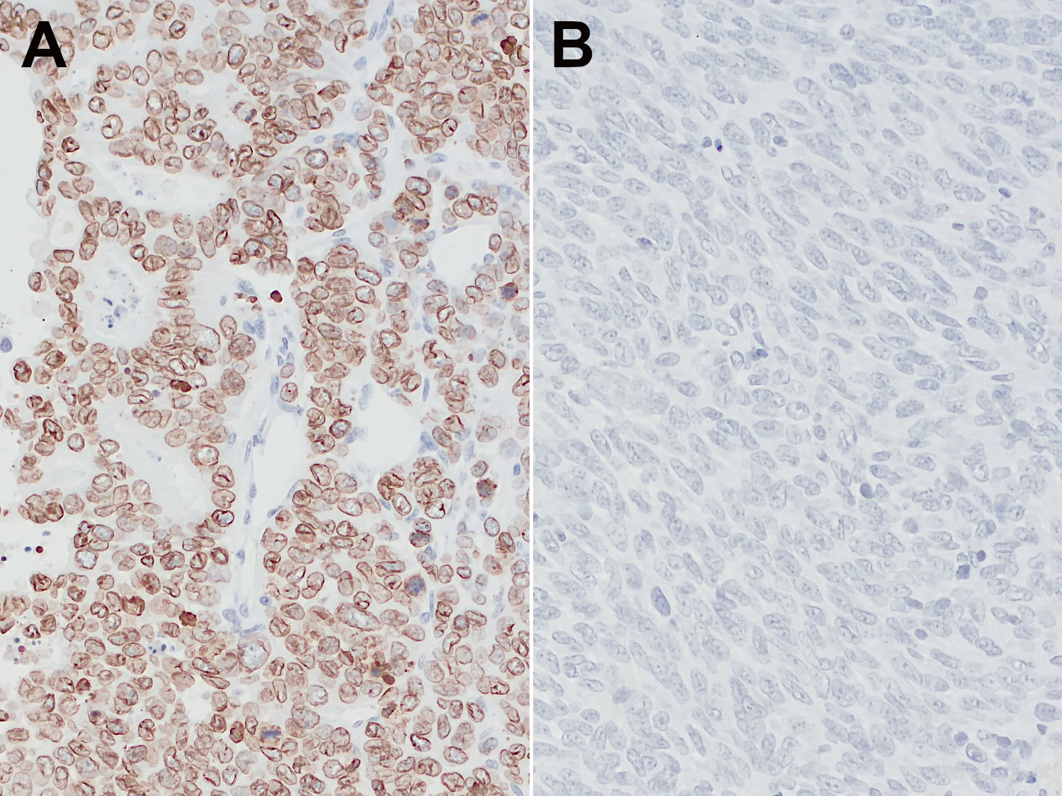 Lamin B1 Recombinant rabbit - image 3