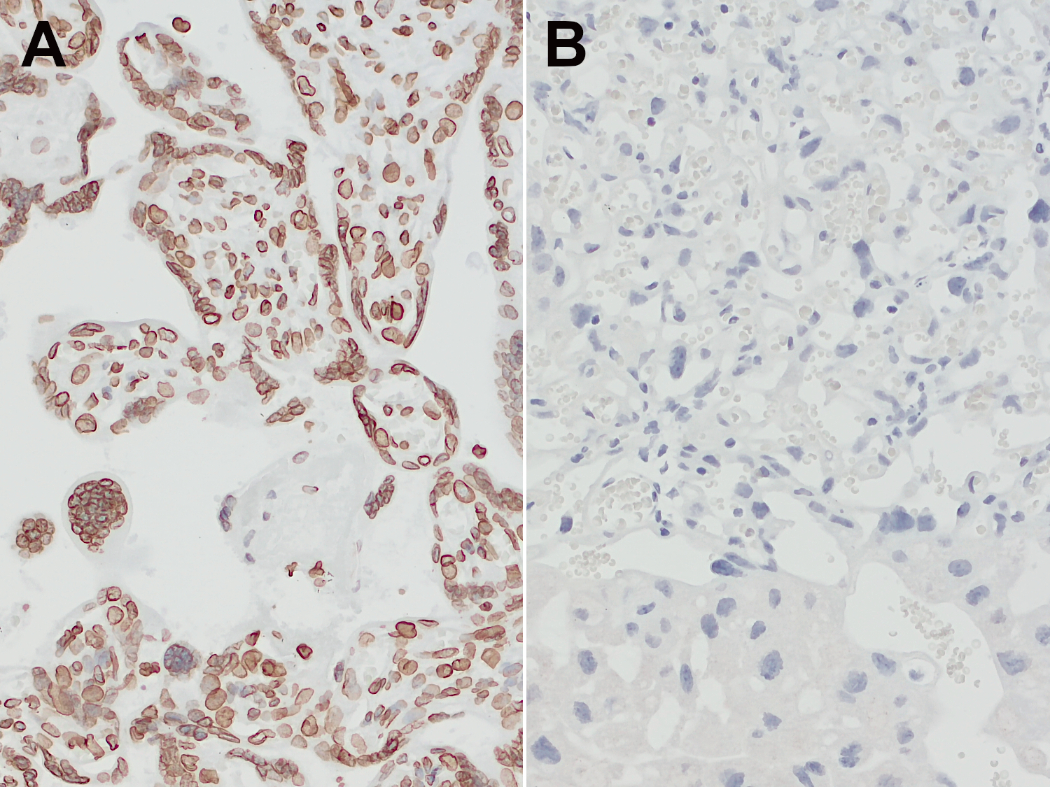 Lamin B1 Recombinant rabbit - image 5