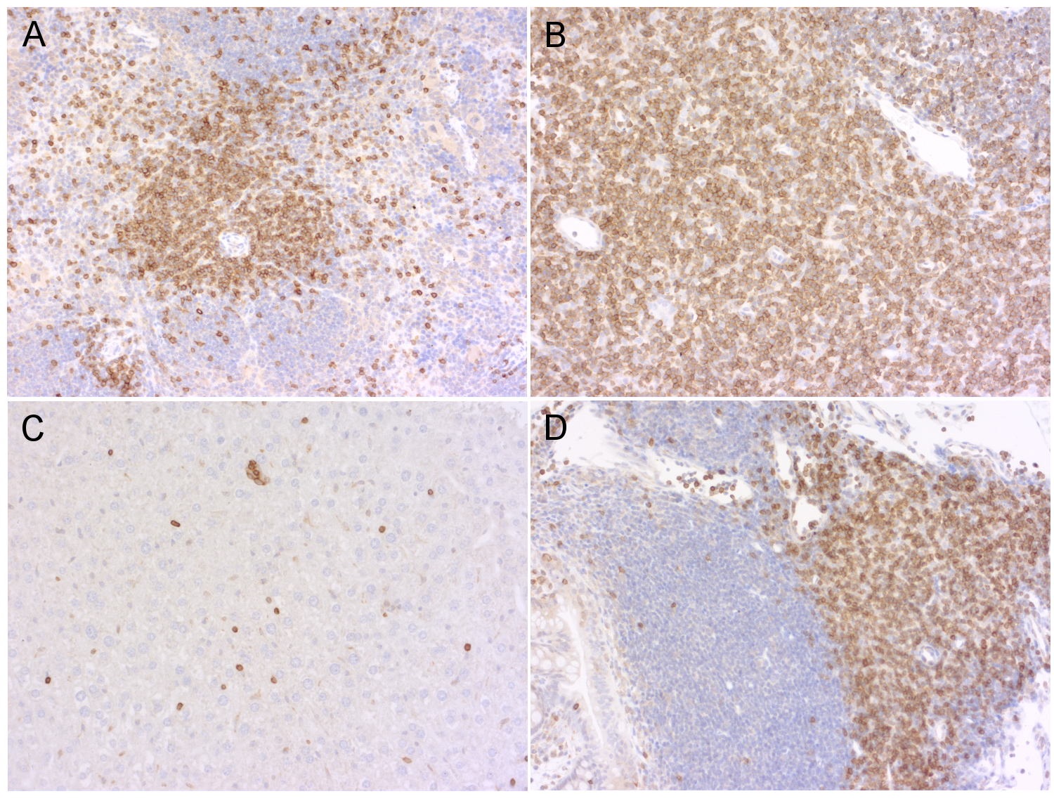 CD3e, Polyclonal rabbit purified antibody
