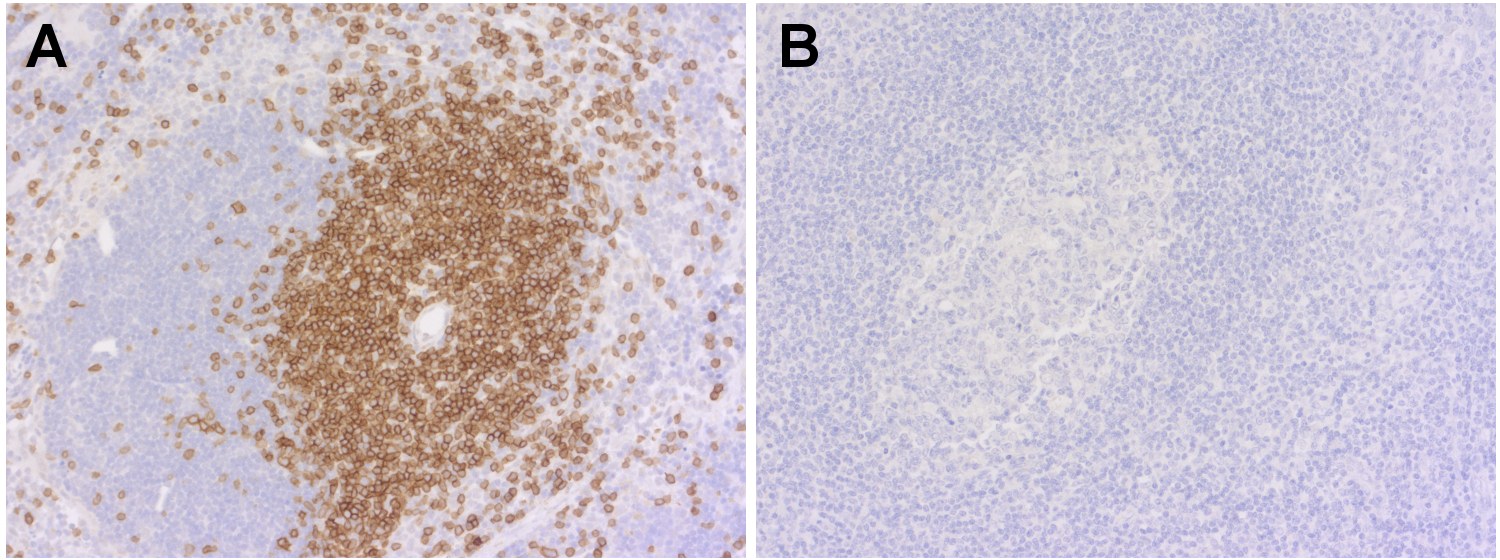 CD3e Recombinant rabbit - image 2