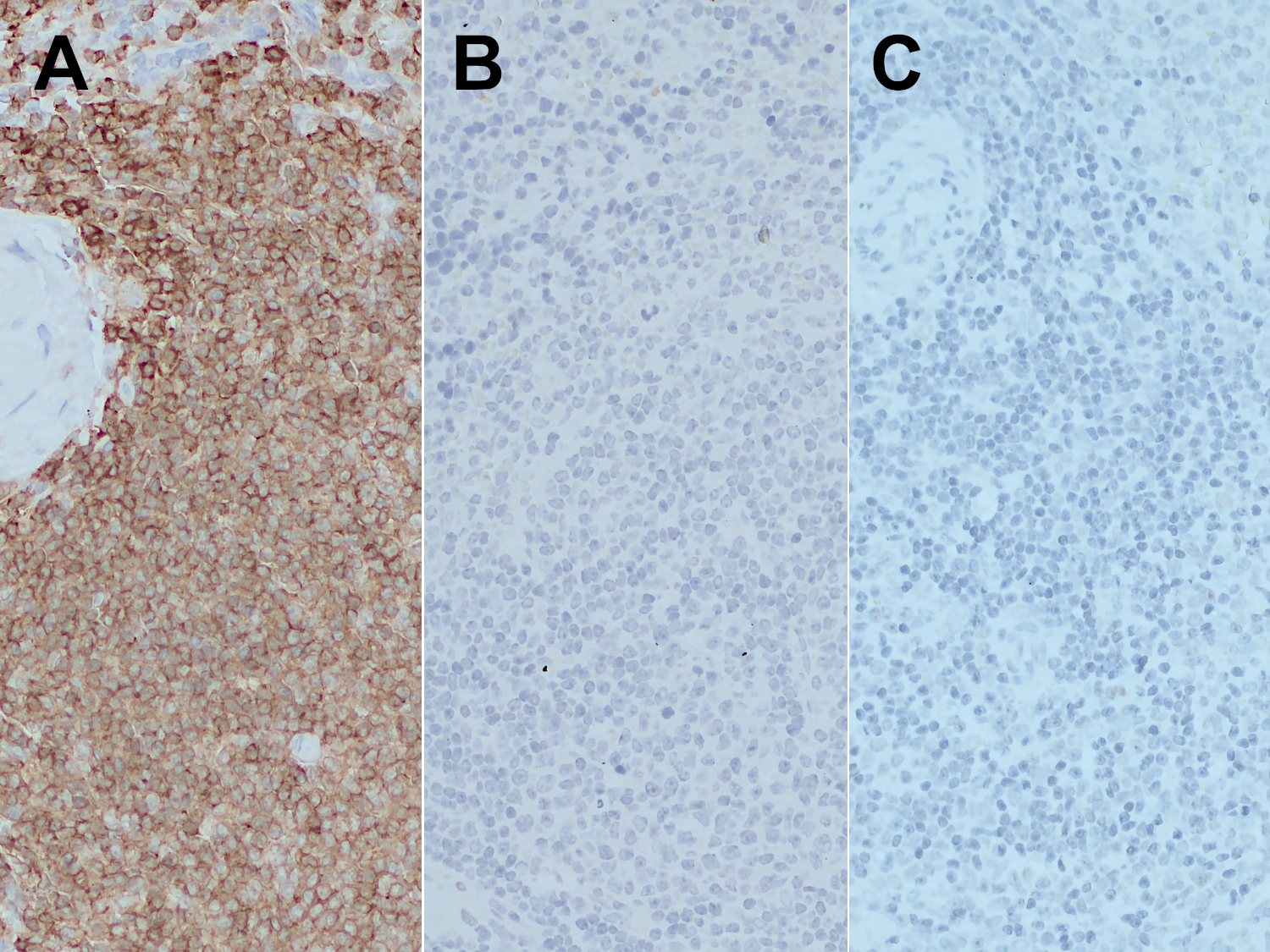 CD45, Polyclonal rabbit purified antibody