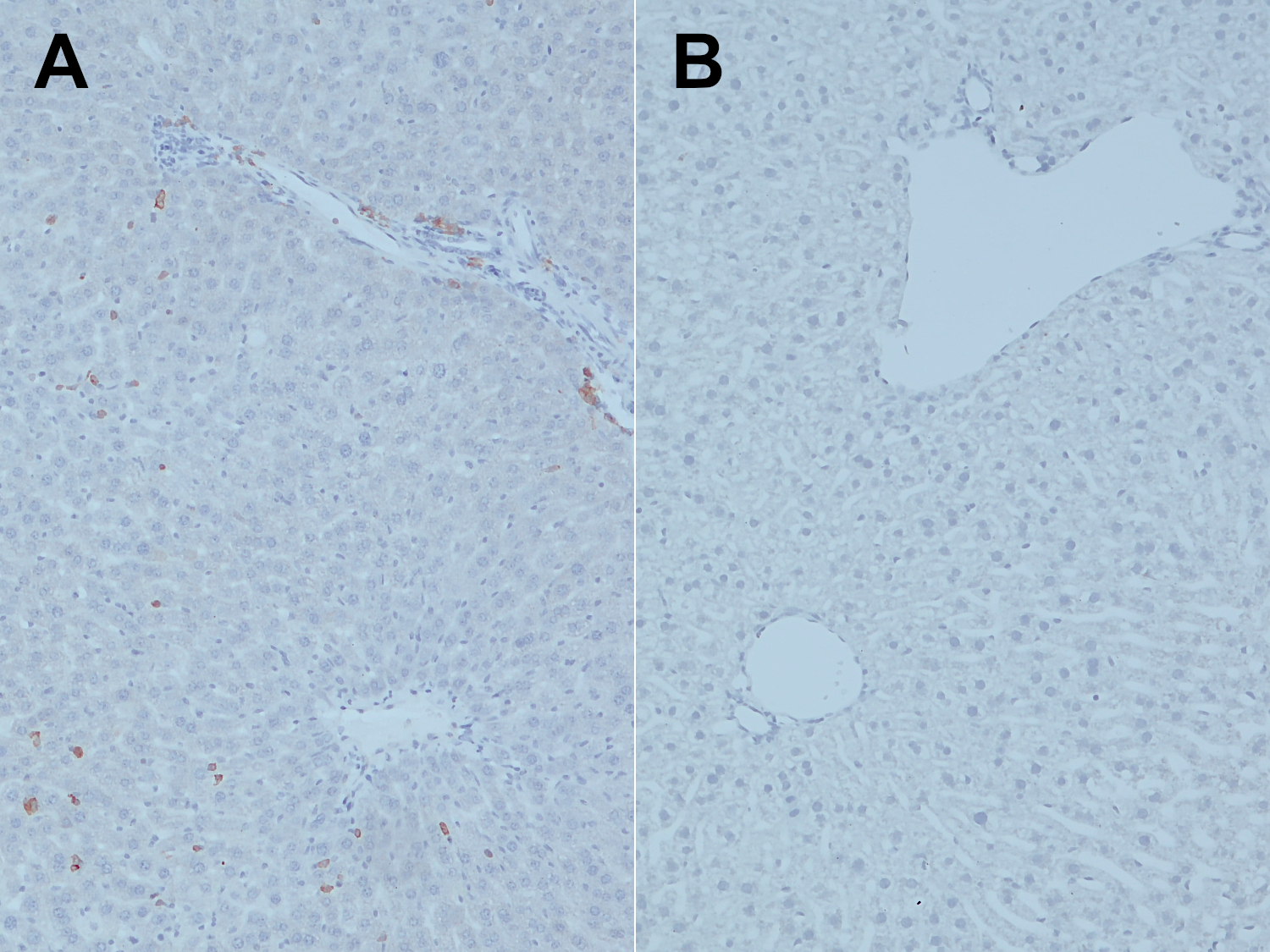 CD45, Polyclonal rabbit purified antibody