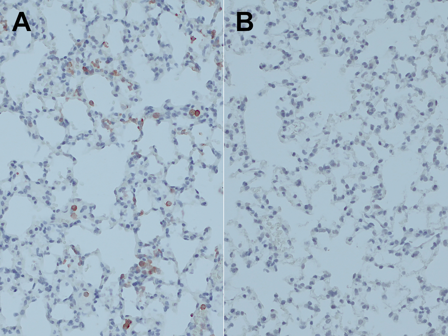 CD45, Polyclonal rabbit purified antibody