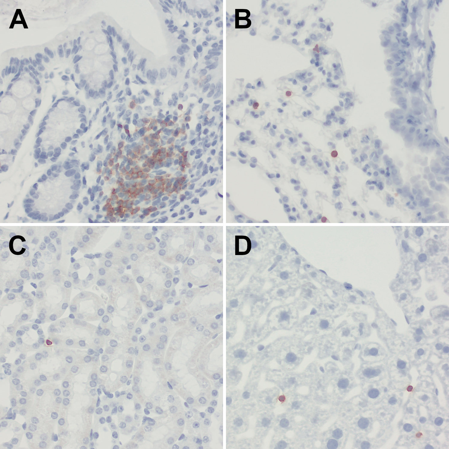 CD19, Recombinant rabbit
