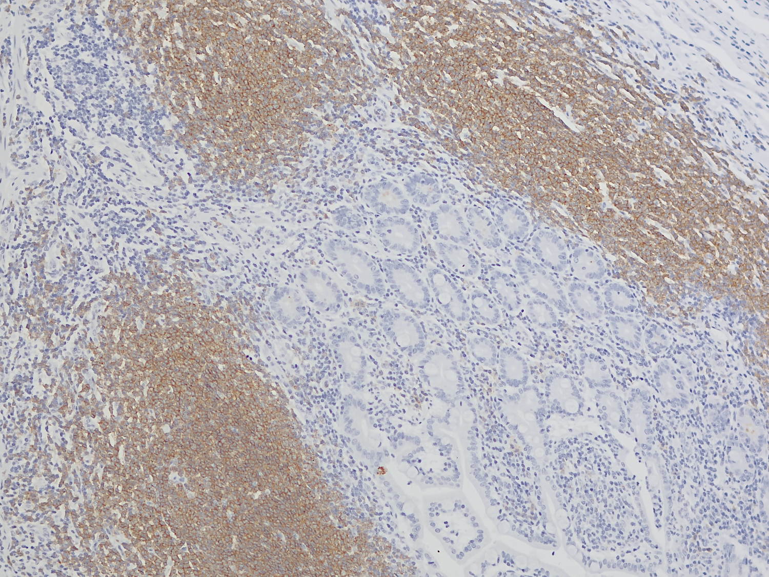 CD19, Recombinant rabbit
