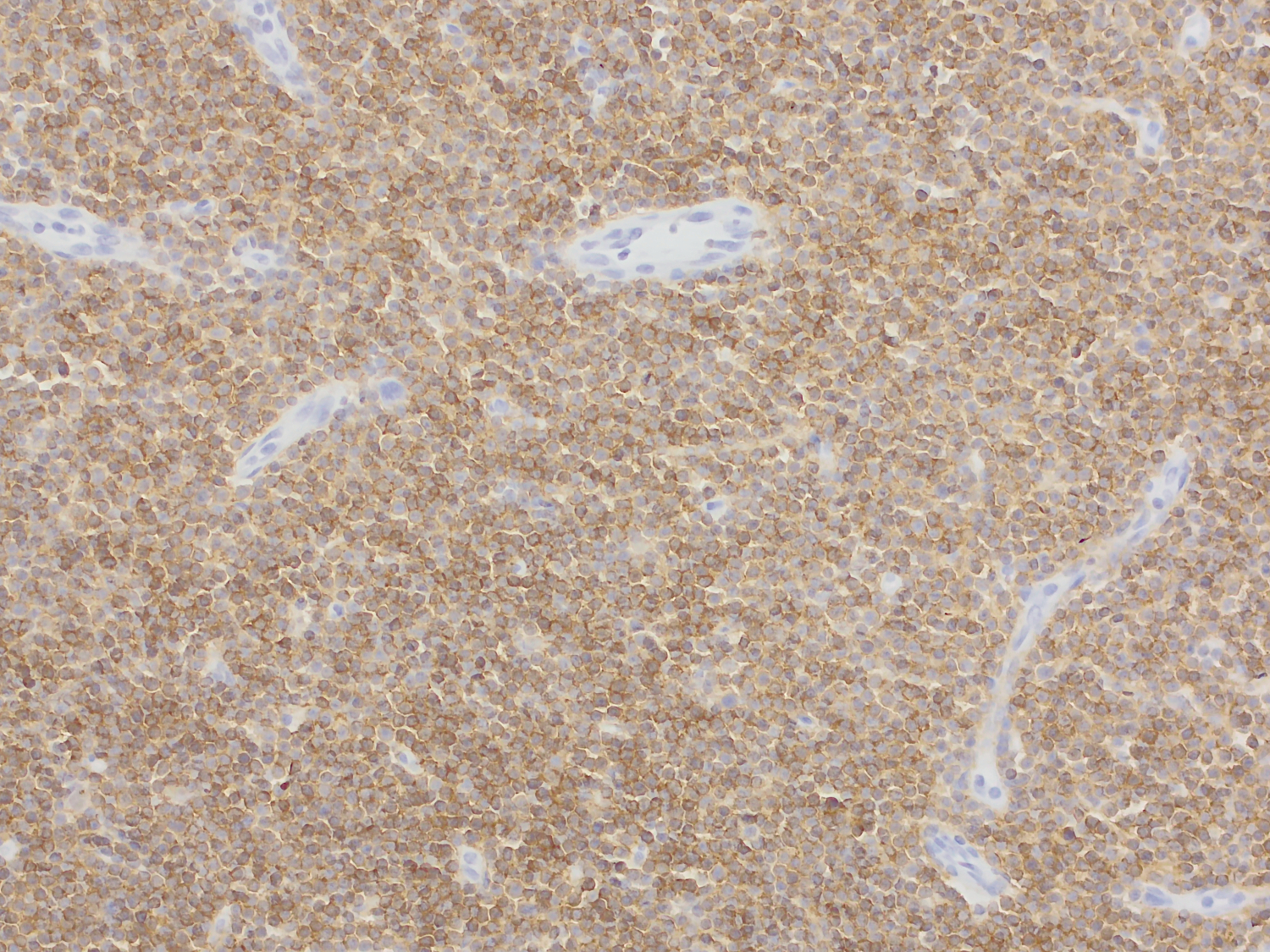 CD19, Recombinant rabbit