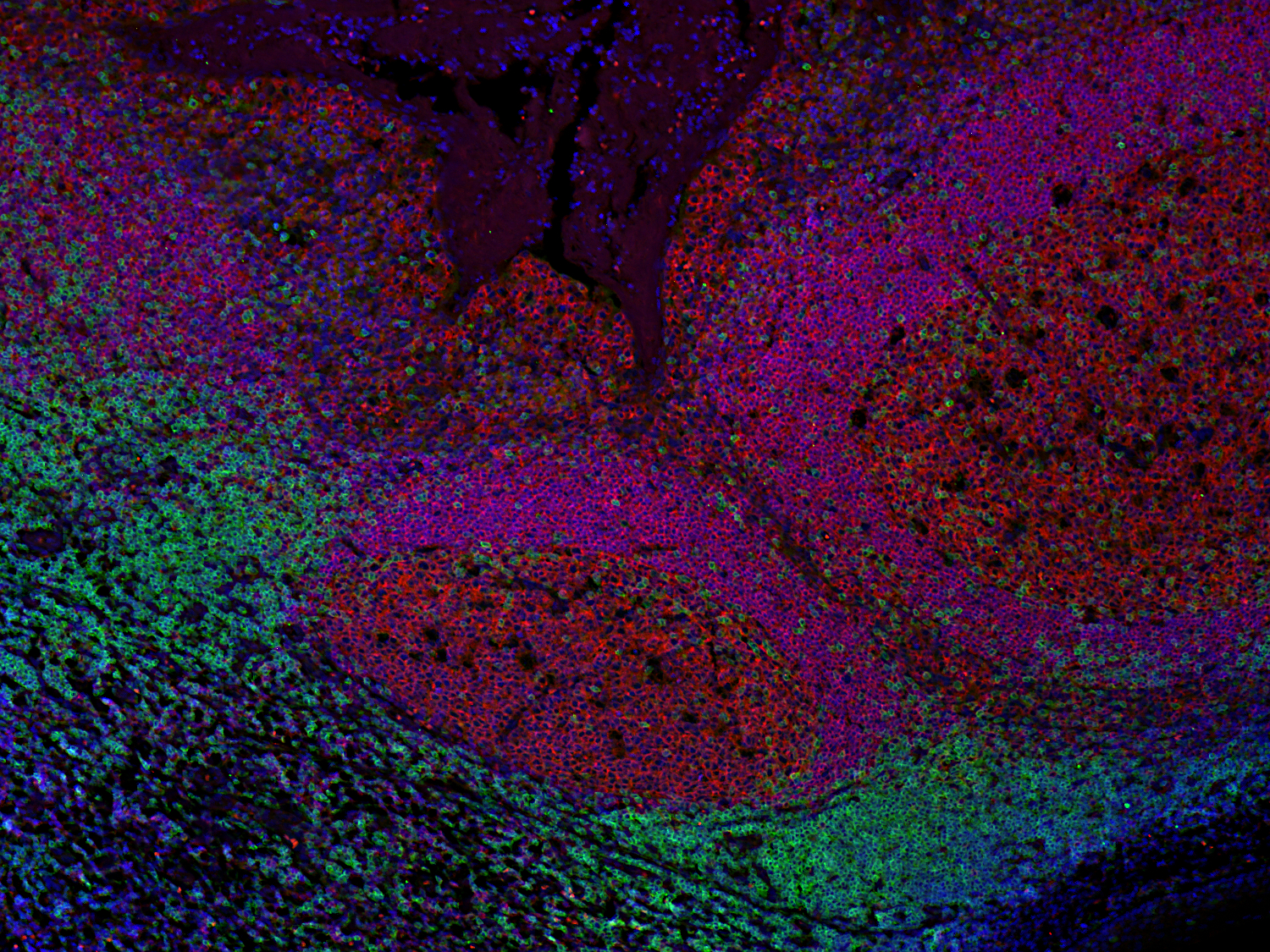 CD19, Recombinant rabbit
