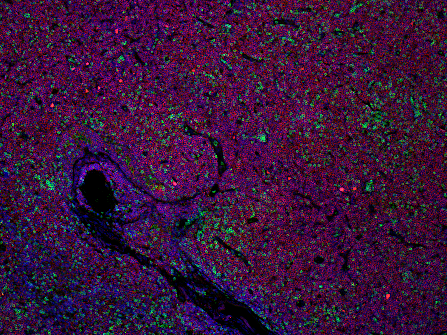 CD19, Recombinant rabbit