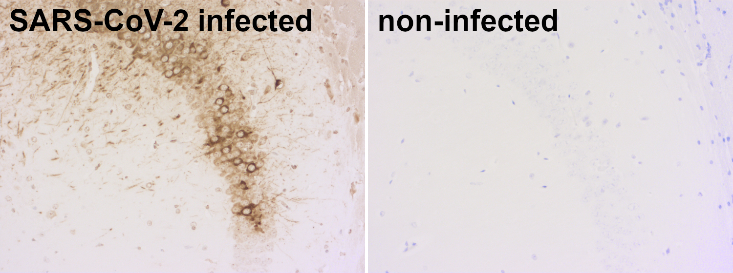 Nucleocapsid CoV-1/2 Monoclonal mouse purified IgG - image 1