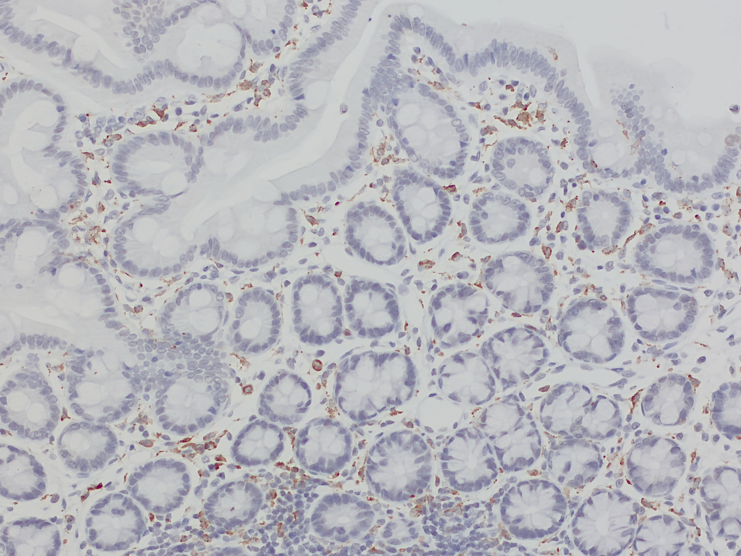 CD68, Polyclonal Guinea pig antiserum