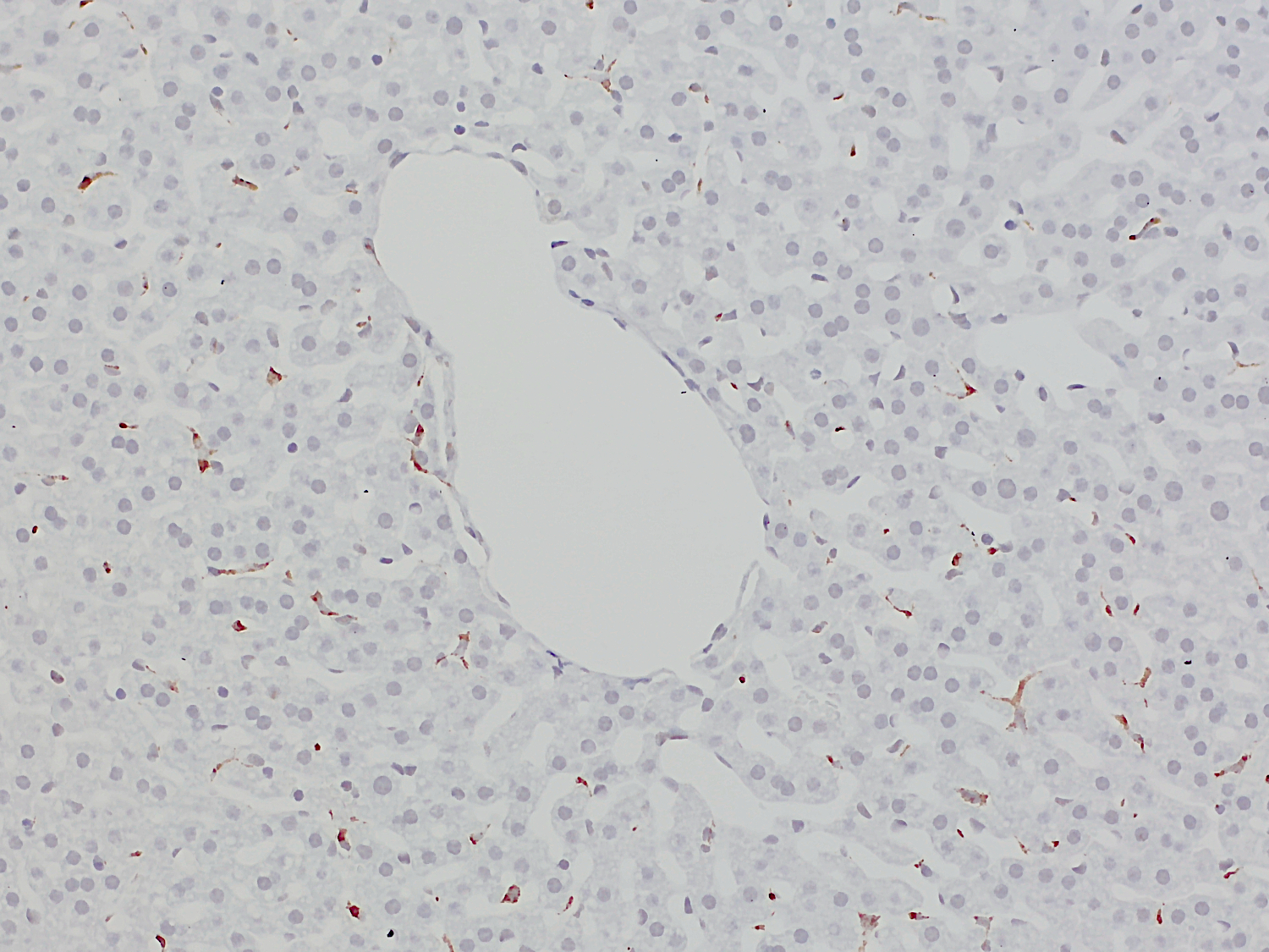 CD68, Polyclonal Guinea pig antiserum