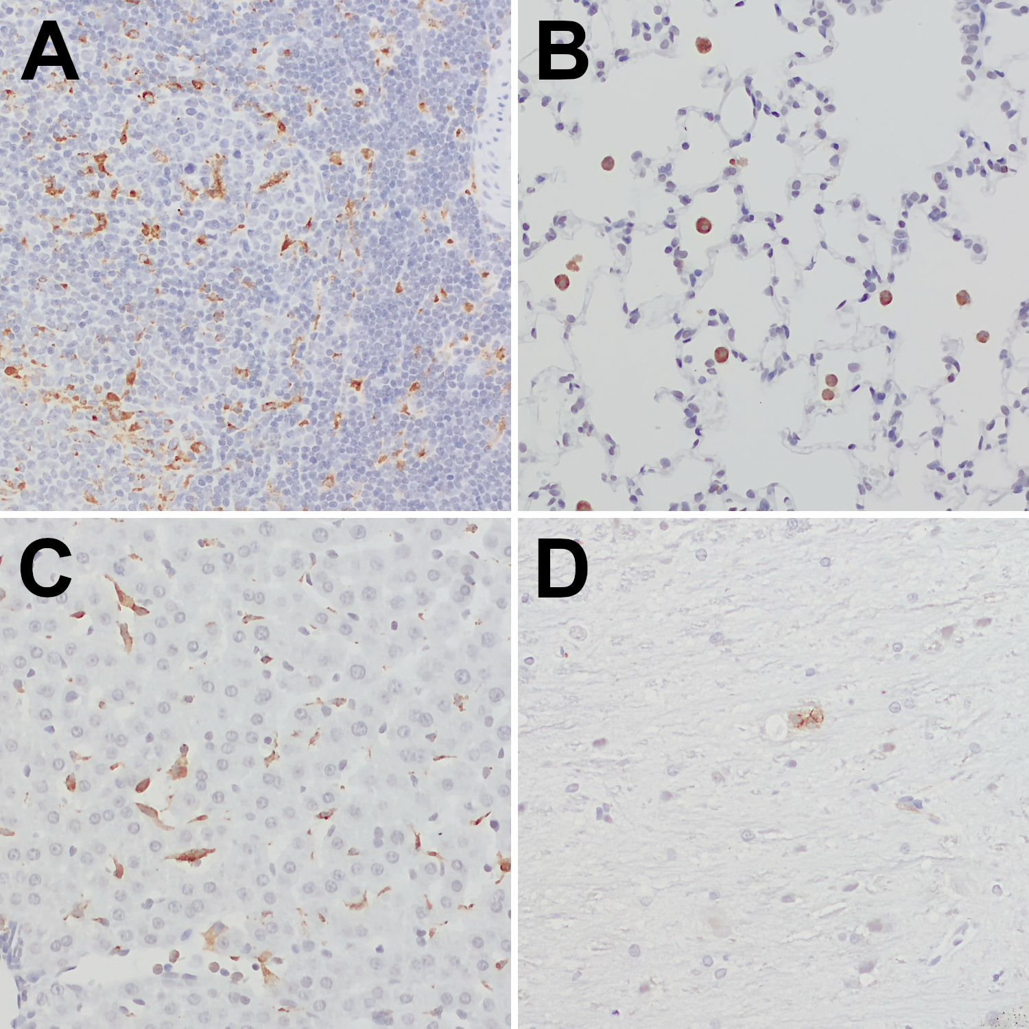 CD68, Polyclonal Guinea pig antiserum
