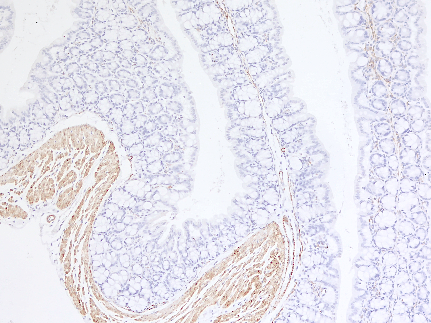 Desmin Monoclonal rabbit - image 5