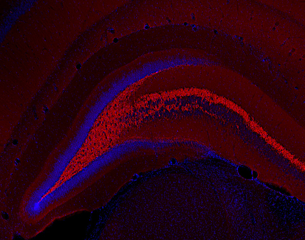 Synaptoporin Polyclonal rabbit antiserum - image 3