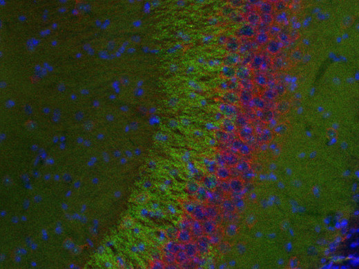 VAMP1/2/3 Polyclonal Guinea pig antiserum - image 3