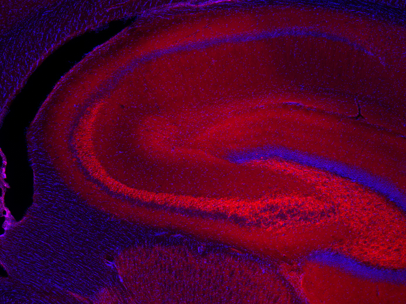 VAMP1/2/3 Polyclonal Guinea pig antiserum - image 4