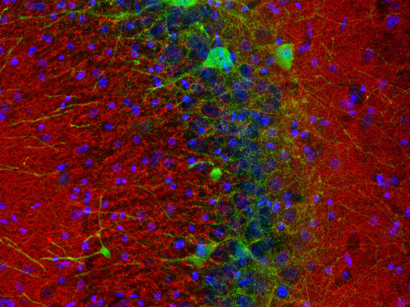 Synaptotagmin1 Polyclonal rabbit antiserum - image 3